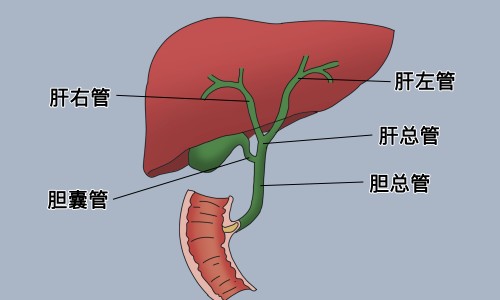 胆结石哪些水果不能吃？